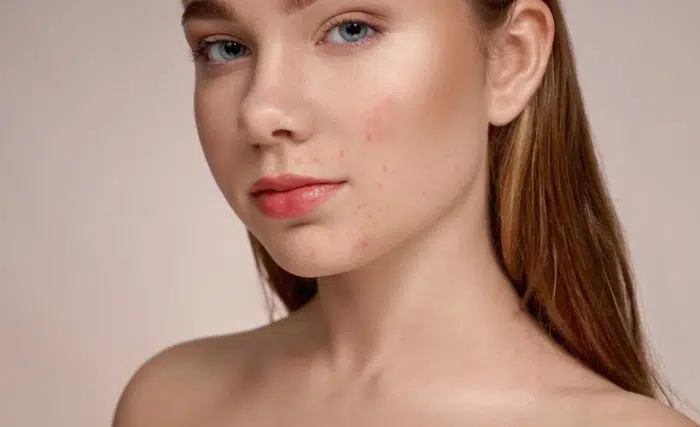 Before skincare comparison illustration